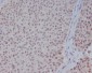 Anti-ERK1 MAPK3 Rabbit Monoclonal Antibody